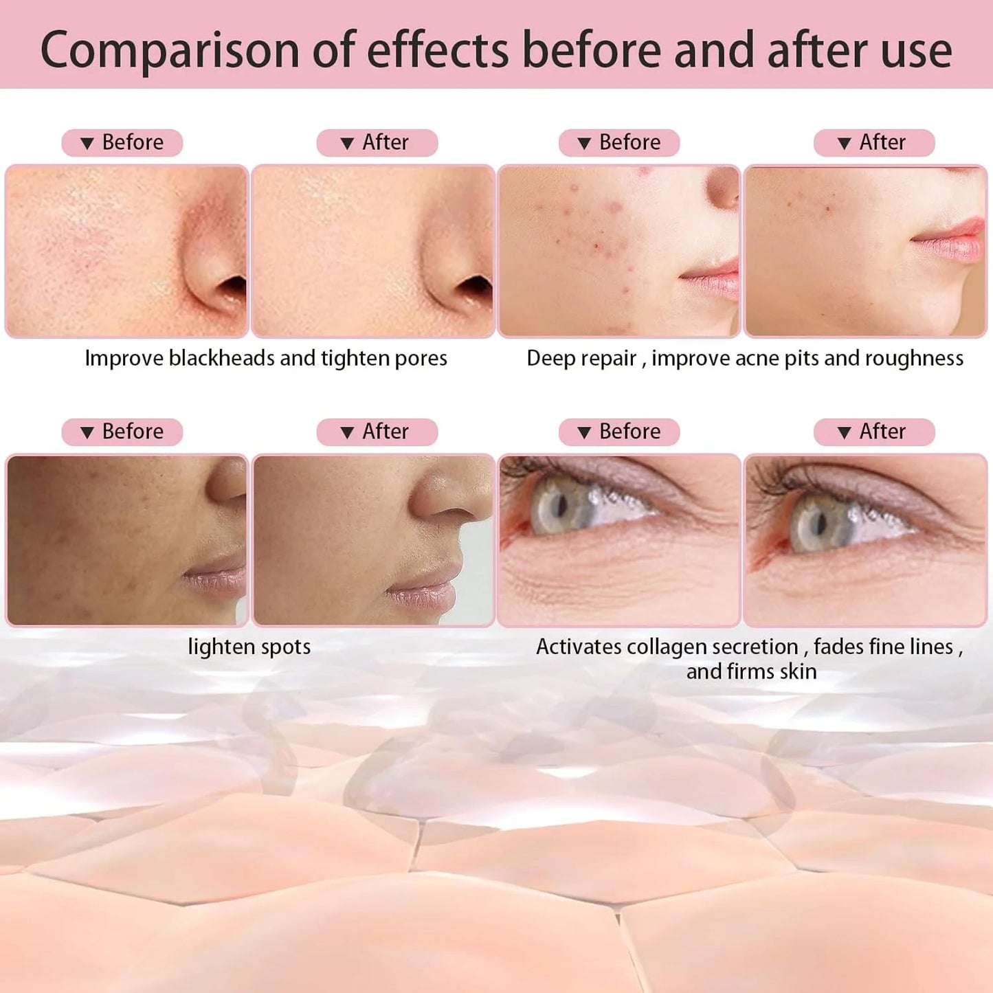 7-Color LED Light Therapy Facial Mask, Anti-Aging, Anti-Acne Skincare, white