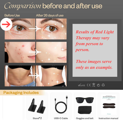 Multifunction Red Light Therapy Mask for Face & Body – LED Light Therapy with Near-Infrared 850nm, Adjustable Intensity, At-Home Skincare Device