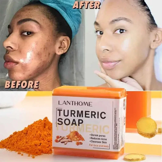 Turmeric Soap with Ginger